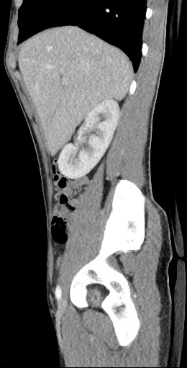 Schwarze und weiße MRI-Aufnahme eines Kniegelenks mit detaillierter Anatomie.